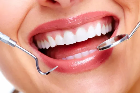 Understanding the Role of Dental Crowns in Restorative Dentistry
