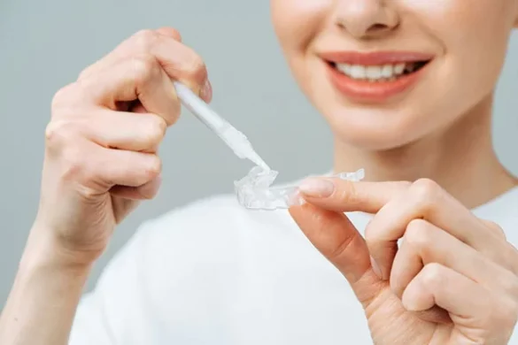 Exploring Teeth Whitening Options for Sensitive Teeth