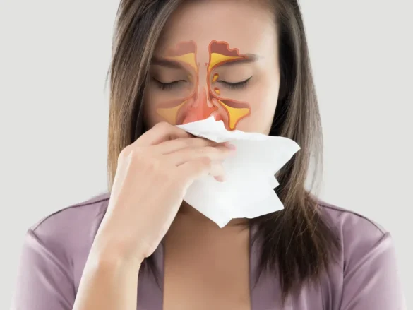 Exploring the Connection Between Sinusitis and Allergies