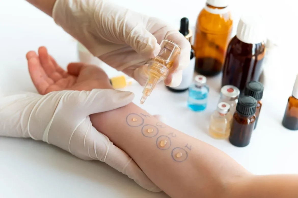 Exploring the Benefits of Allergy Testing for Individuals