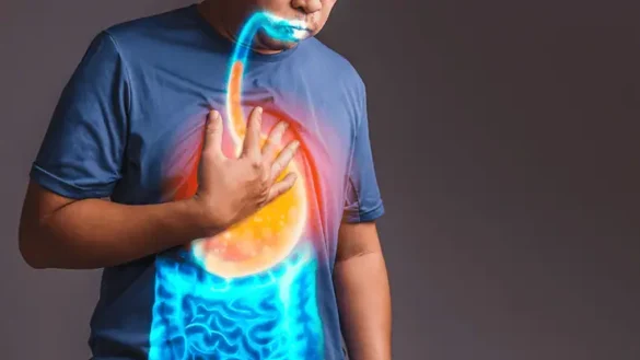 How Acid Reflux Affects Your Daily Life
