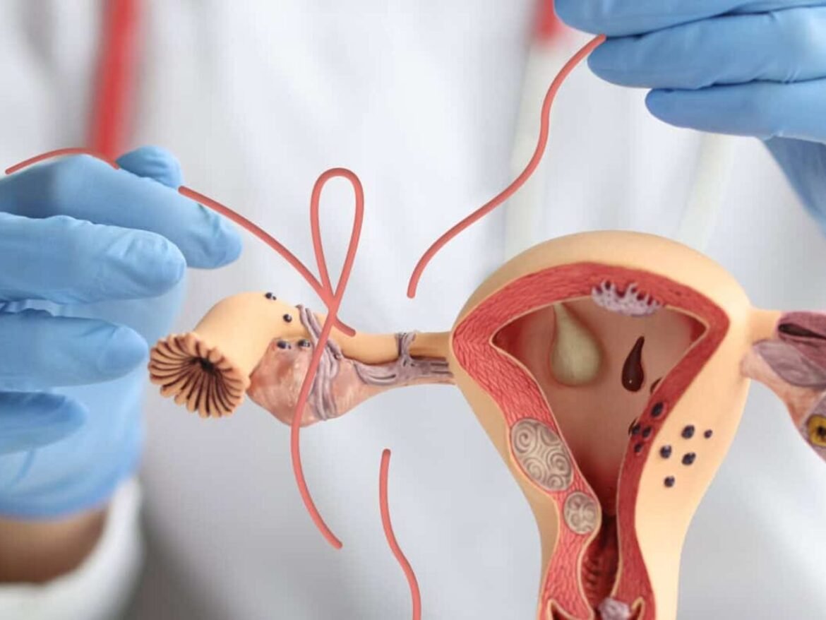 Understanding the Benefits of Tubal Reversal Surgery